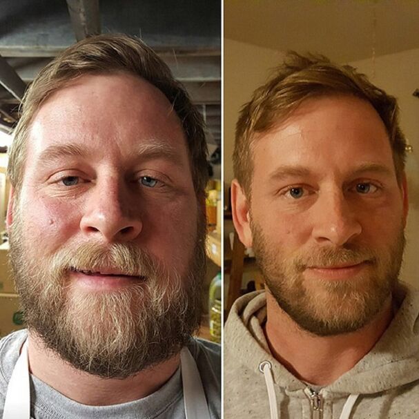 l'aspetto della persona prima e dopo aver rinunciato all'alcol